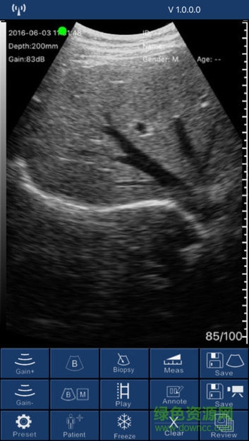 无线超声安卓版