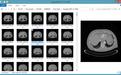 DICOM Thumbnailer(DICOM缩略图查看器)v1.10.5绿色版